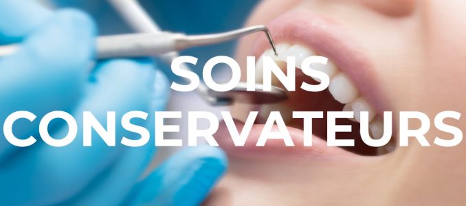 Photo-soins-conservateurs-neosmile-1696x532